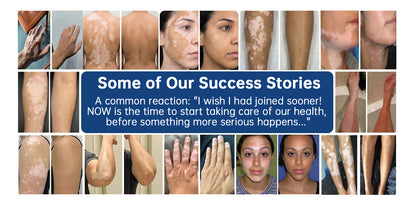 Wake up your skin’s natural colour with YAGOO® Piperine Repigment Activator Spray – formulated to activate dormant pigment cells and restore your true complexion.